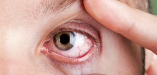 Top 6 Awesome Reasons For Wearing Sclera Contact Lenses